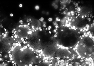 NIR Imaging – Dhyana 95 sCMOS Camera