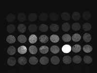 qPCR