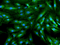 Bone Cells Fluorescence Imaging