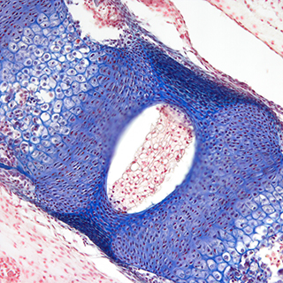 Pathological analysis