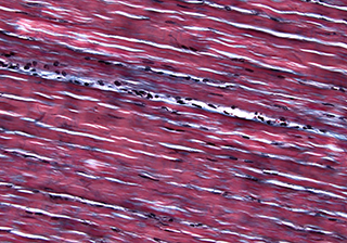 Elastic Fibers Biological Microscopy Imaging