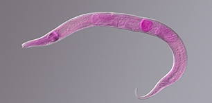 Nematodes DIC &Fluorescence Imaging/ Merge
