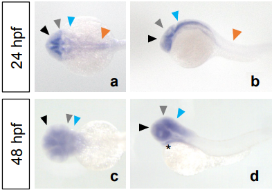 Live Cell Imaging – Vascular defects of DYRK1A knockouts are ameliorated by modulating calcium signaling in zebrafish. Disease models & mechanisms