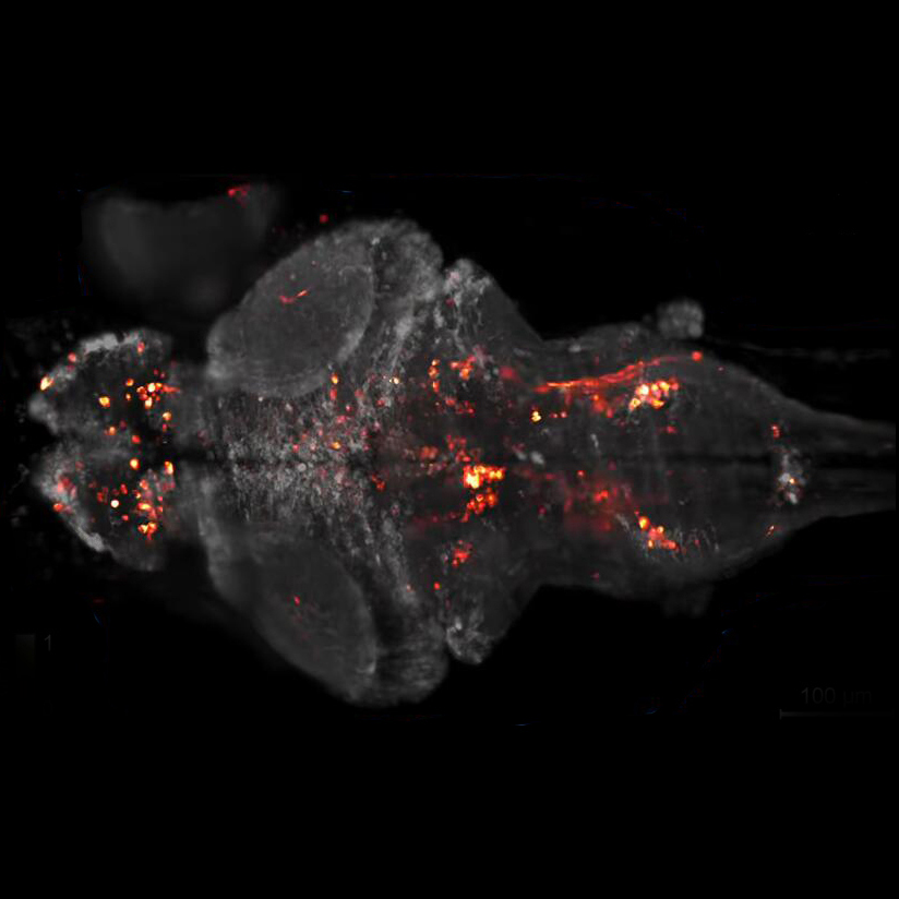 Calcium imaging