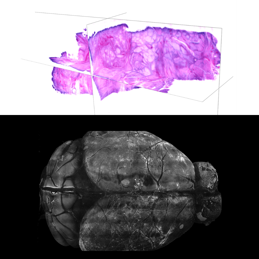 Histology 3D tissue rendering above a high-resolution mouse brain image.