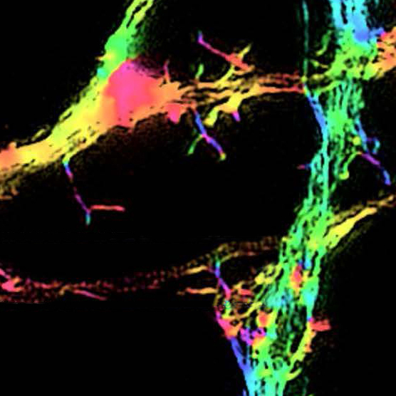 Super resolution imaging