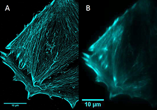 Super Resolution Imaging – Gold Nanorod Photothermal Therapy Alters Cell Junctions and Actin Network in Inhibiting Cancer Cell Collective Migration