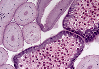 Medical pathology tissue