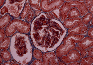Renal Cell Imaging