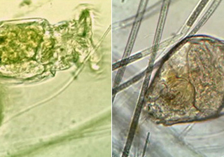 Microscopy Imaging-Tucsen microscope camera video show