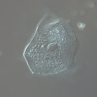 DIC Microscopy