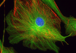 BPAE cell Fluorescence imaging-TrueChrome HDMI Camera
