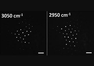 Raman Microscopy Imaging – Wide-field coherent anti-stokes raman scattering microscopy based on picosecond supercontinuum source