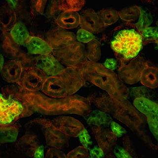 Multicolor fluorescence