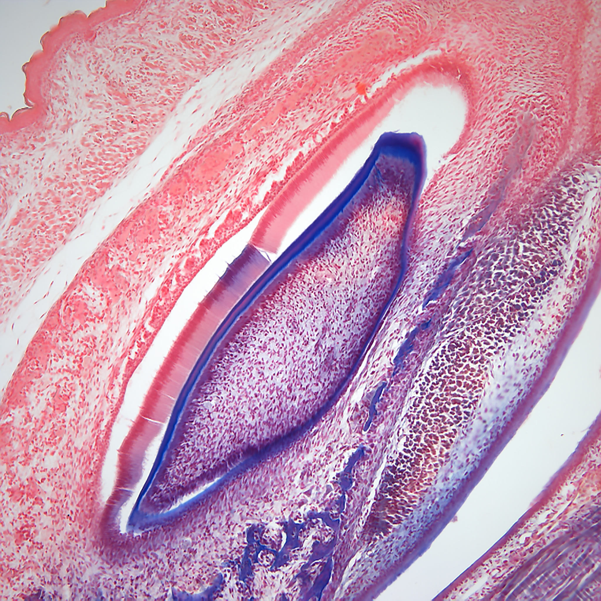 Pathological Analysis