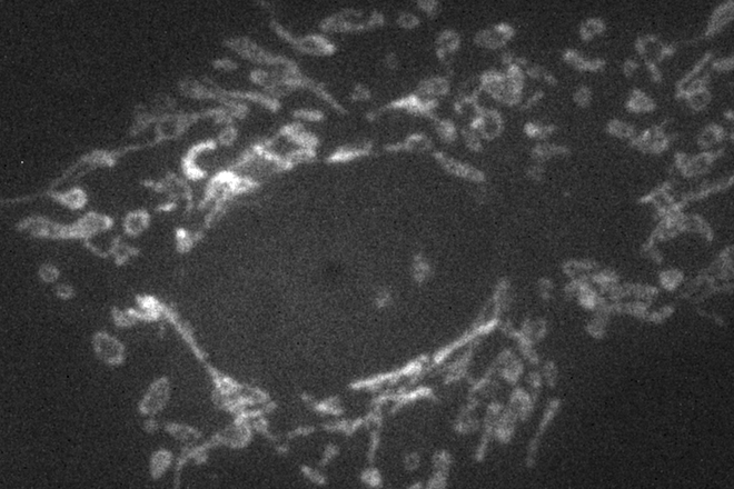 widefield fluorescence microscopy imaging