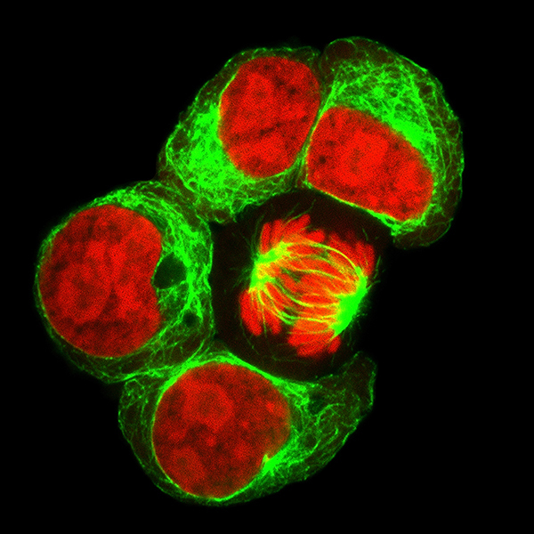 Live-Cell Imaging